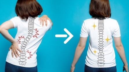 Scoliosis and Posture